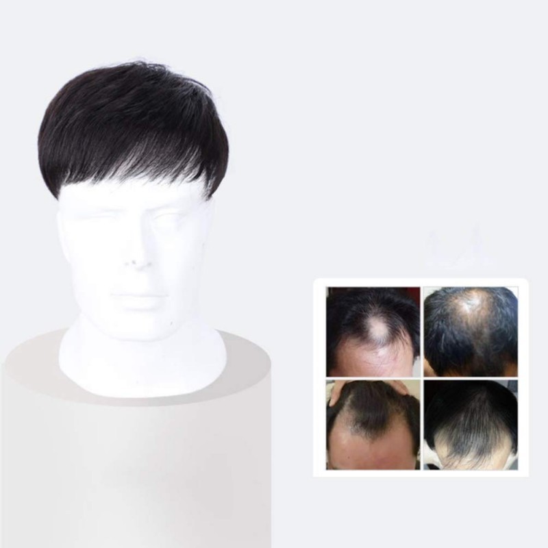 Rambut Palsu Pria Untuk Botak Wig Pria Botak Penutup Botak Sebagian Toupee Botak Depan Pria