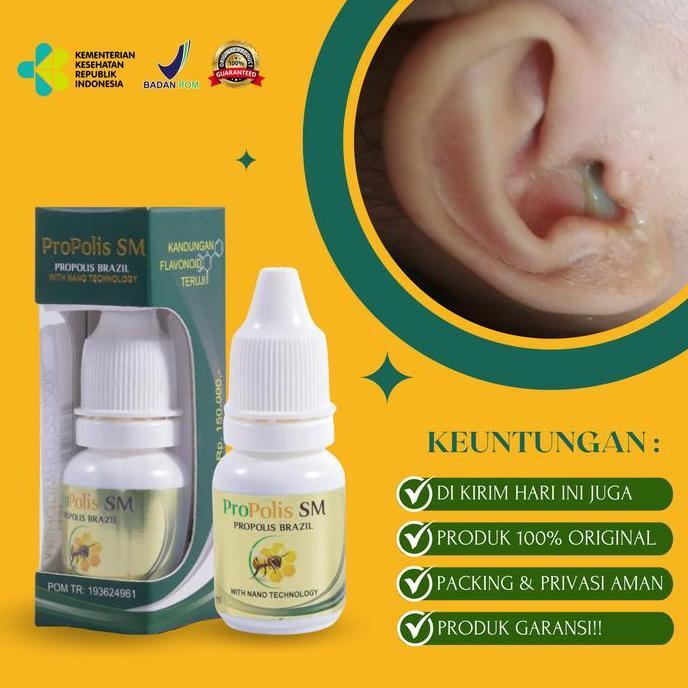 Propolis Sm - Tetes Telinga Conge Curek Berair Bernanah Bau dan Gatal, Obat Tetes Telinga Congek Ber