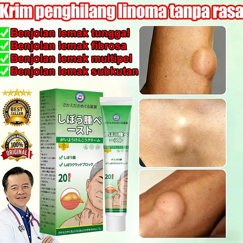 Terlaris Lipoma Cream 20g Lipoma Removal Cream Benjolan Di Leher Tangan Ketiak Salep Lipoma Penghila