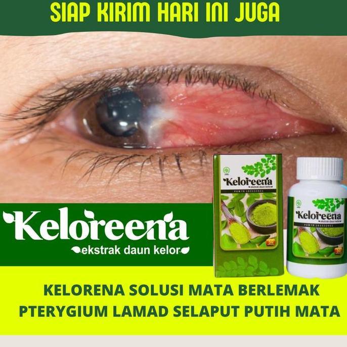 Keloreena Kapsul Solusi Masalah Mata isi 50