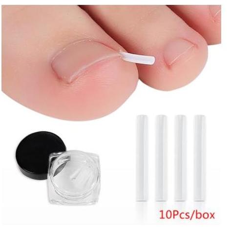 TWOVAN Bantalan Silikon Kuku Ingrown Nail Isolation Pad Mencegah Cantengan