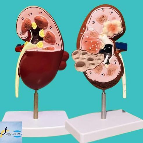 ALAT PERAGA MANEKIN MEDICAL ANATOMI GINJAL/Kerangka Ginjal Manusia