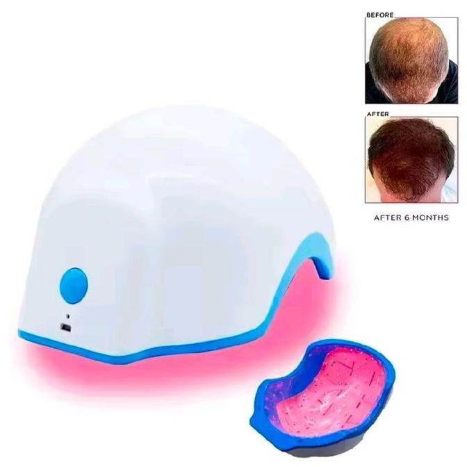 Helm Laser Penumbuh Rambut Topi Penumbuh Rambut Anti Rambut Rontok Perangkat Terapi Rambut Rontok Me