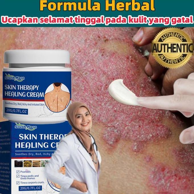 Skinyou- Salep Gatel2 Paling Ampuh / Obat Gatel2 Kulit Ampuh / Obat Gatal / Obat Gatal Gatal Pada Ku