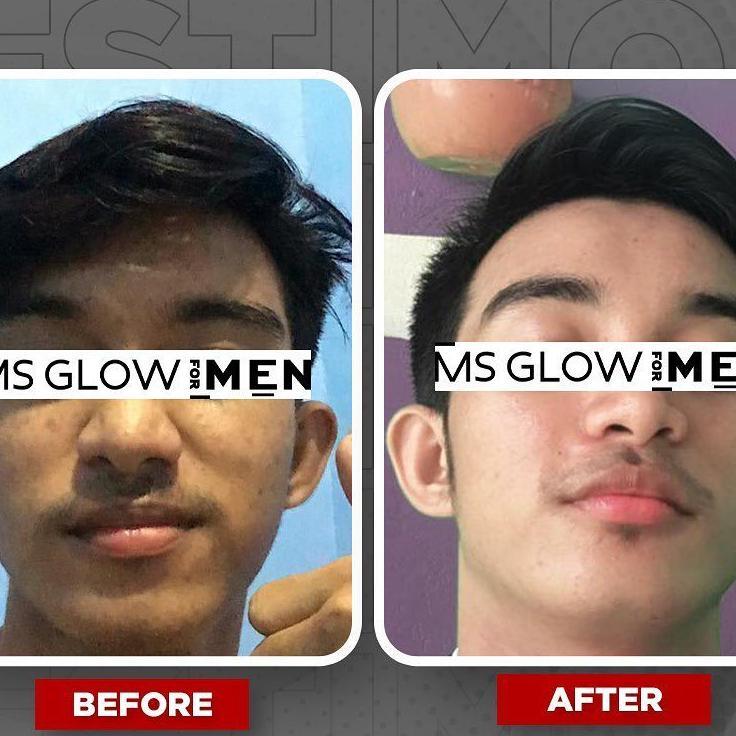 Ms Glow Men Pria 1 Paket Lengkap Maskulin Free Pouch Exclusive Mencerahkan Wajah Pria Cream Pencerah