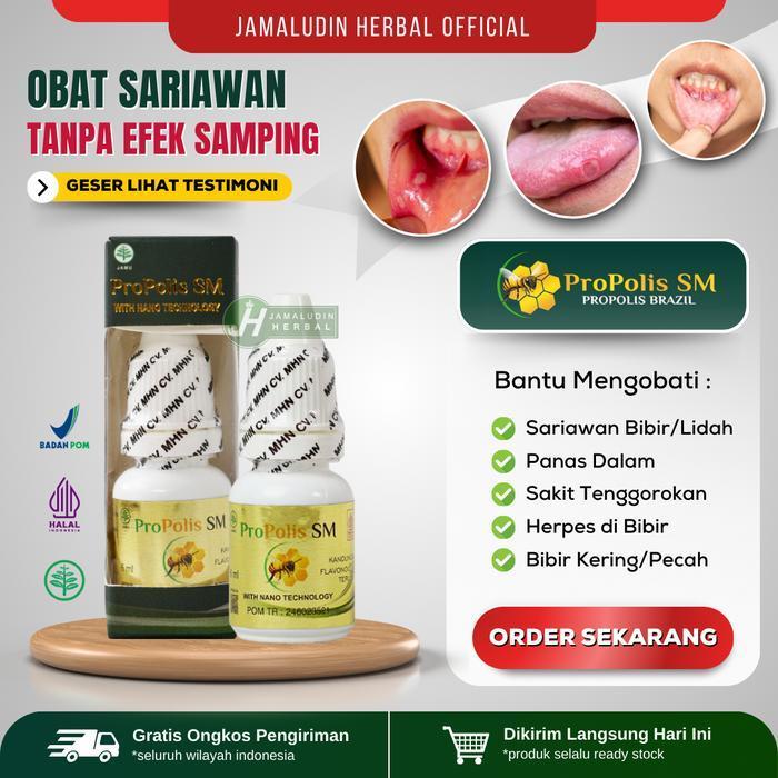 Obat Kumur Sariawan - Propolis Obat Tetes Sariawan Bibir, Lidah, Gusi