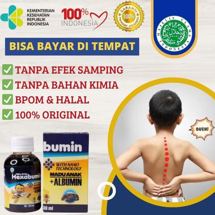 Medova Vitamin Kalsium Tulang Anak, Vitamin Penguat Tulang Dan Otot Anak Bayi Sembuhkan Patah Tulang