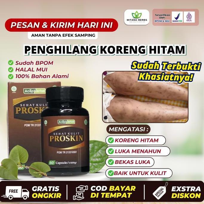 Penghilang Luka Berbekas Koreng Hitam di kaki Bekas Luka Menahun  Koreng Bernanah Bekas Gigitan Nyam