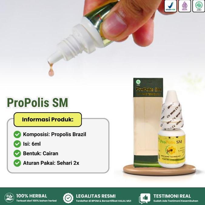 Propolis SM Herbal Pembersih Telinga Penghilang Kotoran di Telinga yang Keras Ear Kuping ofloxacin  