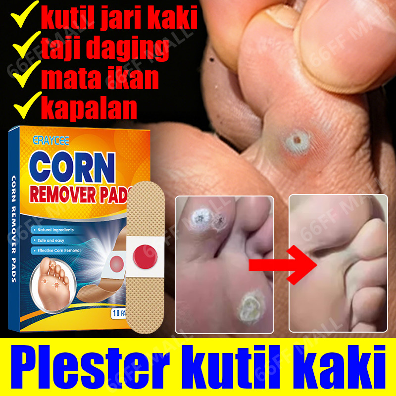 plester mata ikan obat mata ikan plester kutil salep mata ikan telapak kaki obat untuk mata ikan cor