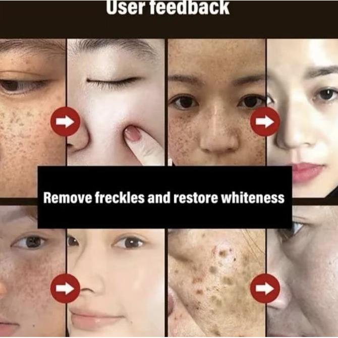 Utsukushi- Masker Wajah Menghilangkan Bintik-Bintik Topeng Koyak Anti Penuaan & Anti Kedut Kolagen 1