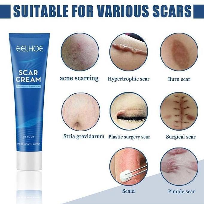 Skinyou- Salep Bekas Luka Ampuh Dermatik Salep Penghilang Bekas Luka Ori/Obat Penghilang Bekas Luka 