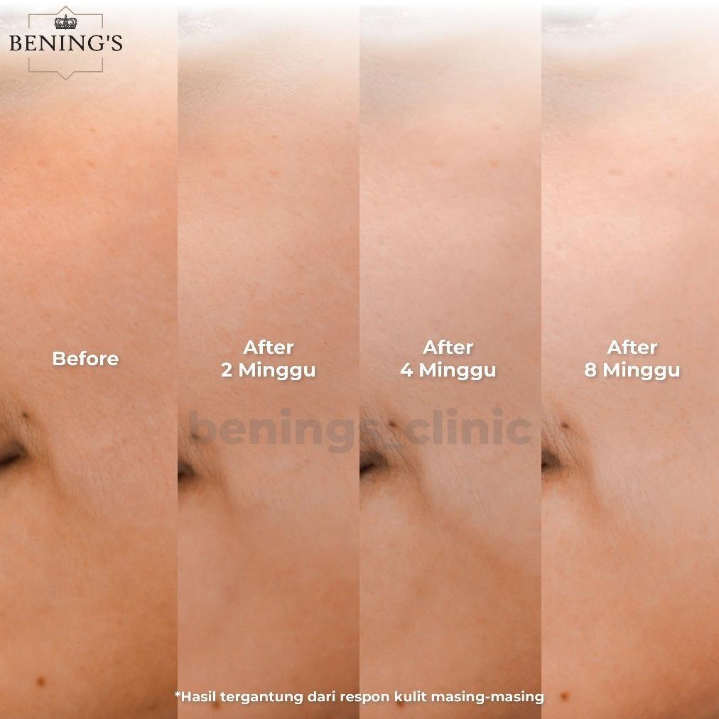 Cushion Natural Glowing By Benings skincare dr oky pratama Bening's Clinic Dr Oky
