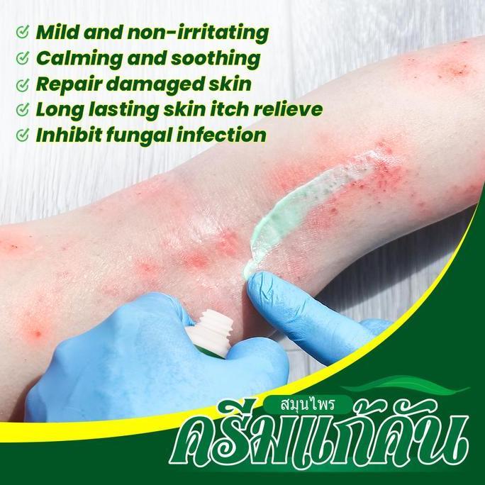 Readybanyaknih- Obat Gatal Paling Ampuh Krim Pereda Gatal Obat Selangkangan Gatal P Kurap Paling Amp
