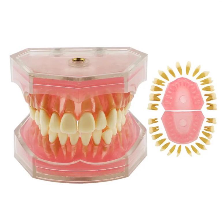Dental Study Model Typodont Gigi Bisa Dilepas Phantom Studi Edukasi Gusi Karet Soft Rubber Gingiva