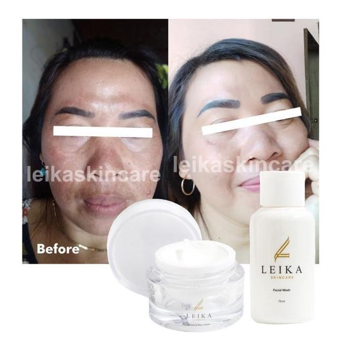 Paket 2in1 Day Cream & Sabun Penghilang flek hitam di wajah Bpom Halal MUI Cream Menghilangkan flek 