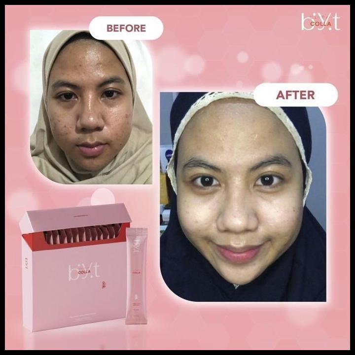 Byt Colla 10 Box (160 Sachet), Minuman Kecantikan Jepang Memutihkan & Mencerahkan Kulit, Tripeptide 