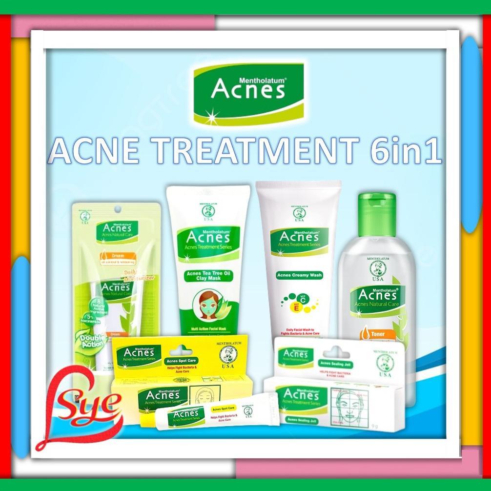 Acnes Paket Hemat 6 In 1 - Creamy Wash - Spot Care - Sealing Jell - Cream Perawatan Jerawat - Sye