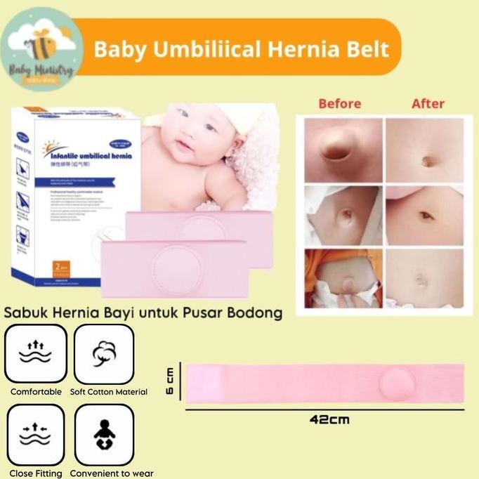 HONS BABY UMBILICAL BELT HERNIA (SABUK HERNIA) PUSAR BODONG