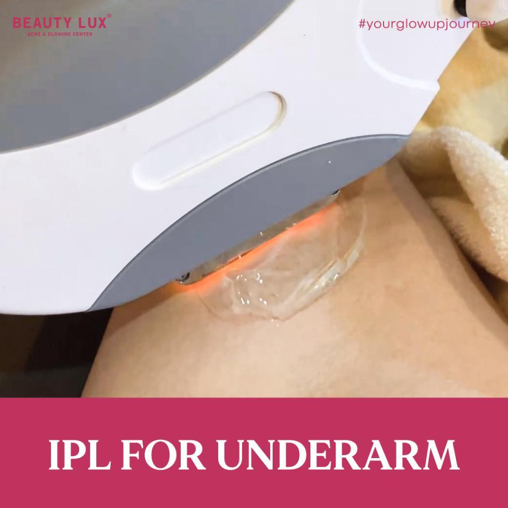 NEW IPL UNDERARM 12X PACKAGE [terbaik][terlaris]