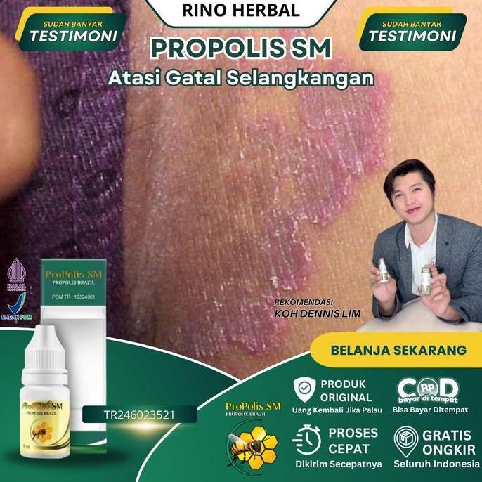 Selangkangan Hitam Dan Gatal, Selangkangan Lecet, Jamur Selangkangan, Selangkangan Hitam, Gatal Sela