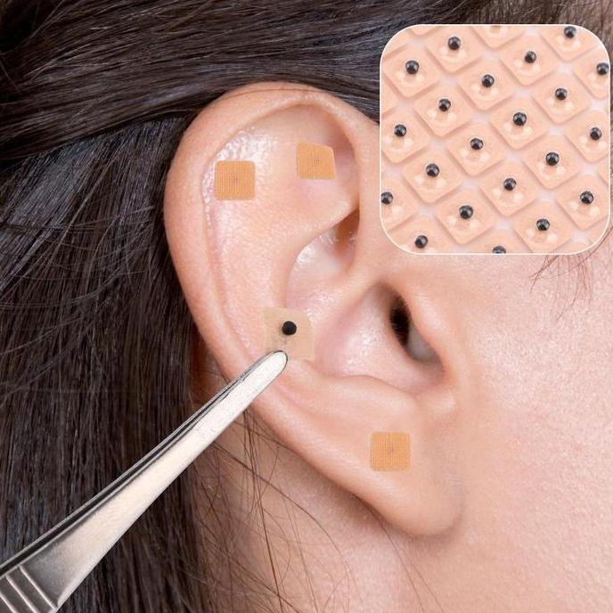 DZAPIRA 60Pcs Koyo Pijat Telinga Biji Terapi Telinga Plester Akupuntur Moksibusi Biji Akupunktur Tel