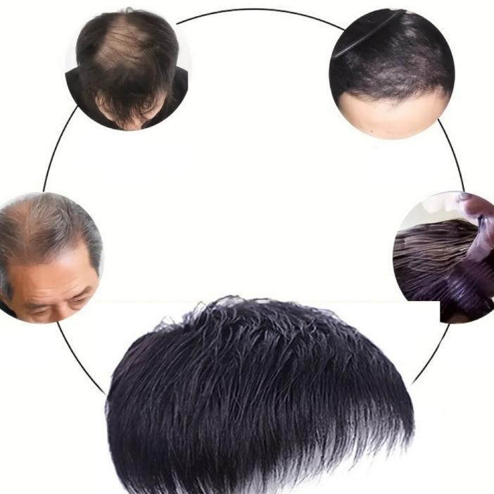 Wig Rambut Palsu Pria Botak Toupee Penutup Botak Wig Depan Toupee Pria Rambut Simulasi