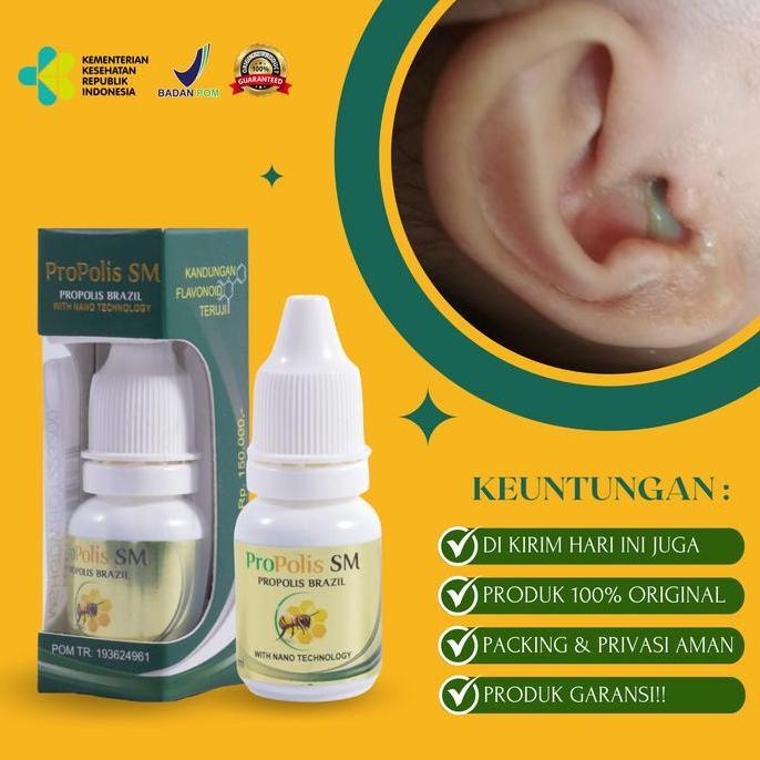 Propolis Sm - Tetes Telinga Conge Curek Berair Bernanah Bau dan Gatal, Obat Tetes Telinga Congek Ber