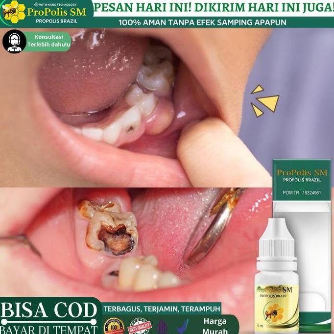 Obat Penghancur gigi Berlubang, Perontok Akar Gigi dan Karang Gigi
