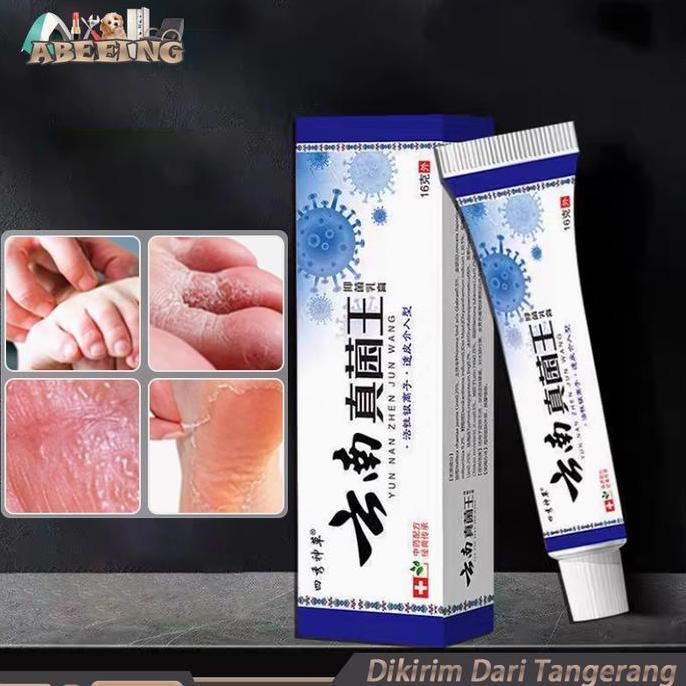 FKINAPE Obat Kaki Rayapan Dan Bau Obat Kaki Rayapan Penghilang Bau Kaki Obat Kaki Rayapan Paling Sal