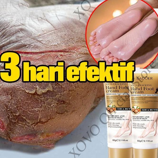 Pelembab Kaki Pecah Dan Kering Kaki Kaki Pecah Dan Kering Krim 60G P Kaki Pecah Pecah Kering