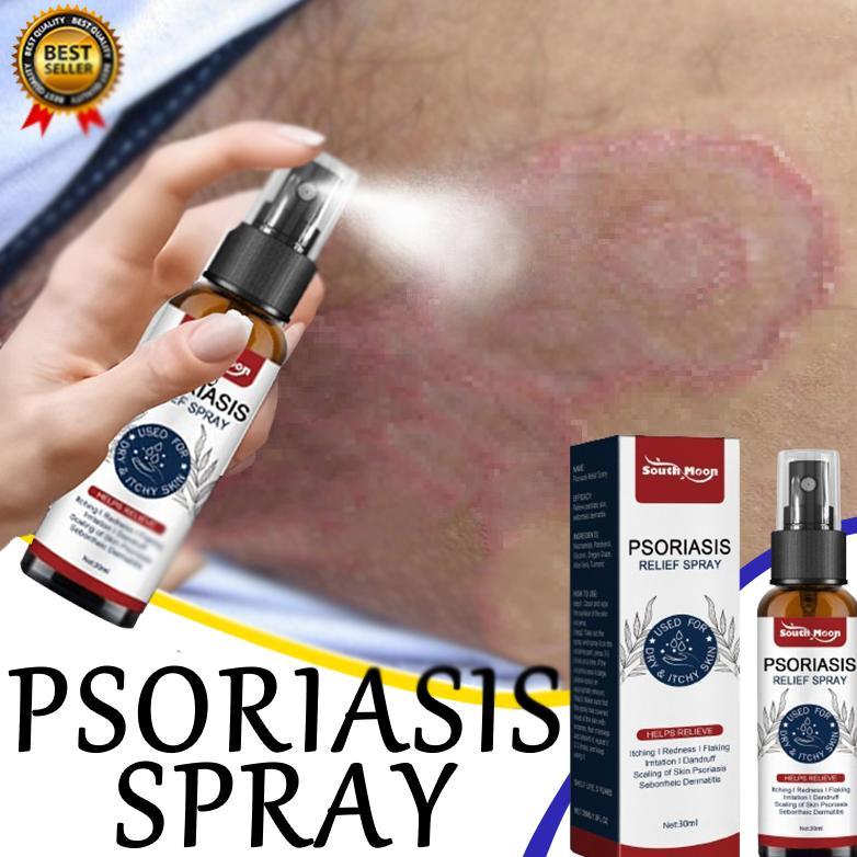 BPOM - Salap gatal kulit yang Obat gatal selangan Obat gatal gatal gatal selangan 30ml obat gatal ku