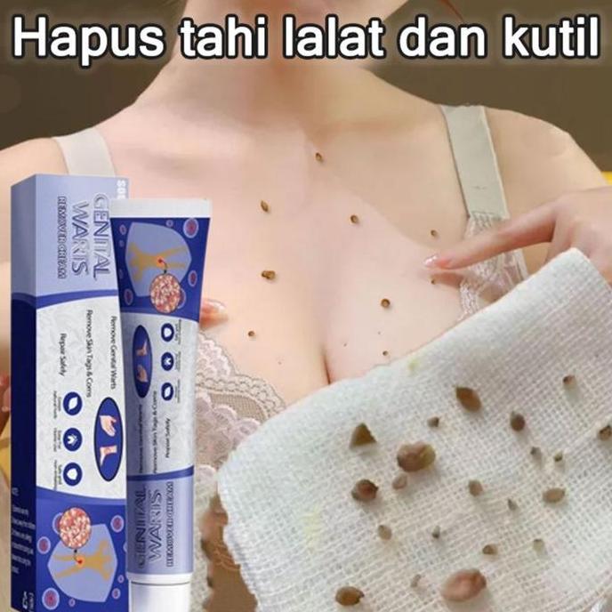 PENGHILANG KUTIL DAN TAHI LALAT LEHER PENGHILANG KUTIL WAJAH WART REMOVAL CREAM KUTIL LEHER