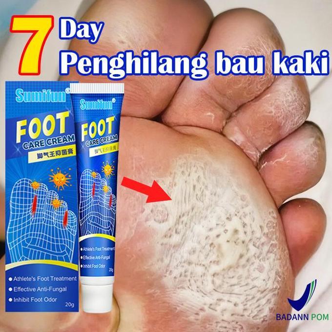 Obat Jamur Kaki Salep penghilang bau kaki Anti Jamur Kaki Gatal&Kurap/obat jamur kaki/Henti gatal ce