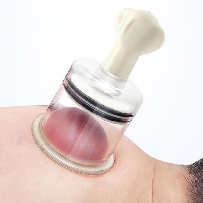 JHONXIE Alat Bekam Kop Angin Vakum Set Bekam Terapi Dengan Twist Pump Kop Angin Alat Bekam Manual