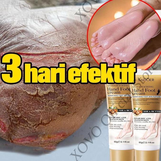 pelembab kaki pecah dan kering kaki obat kaki pecah dan kering krim 60g salep kaki pecah pecah kerin