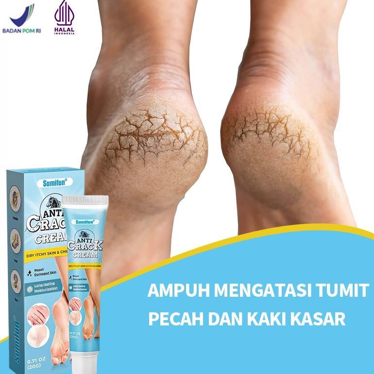NEW Krim kaki pecah dan kering salep kaki pecah dan kering ampuh perawatan kaki pecah dan kering 20g