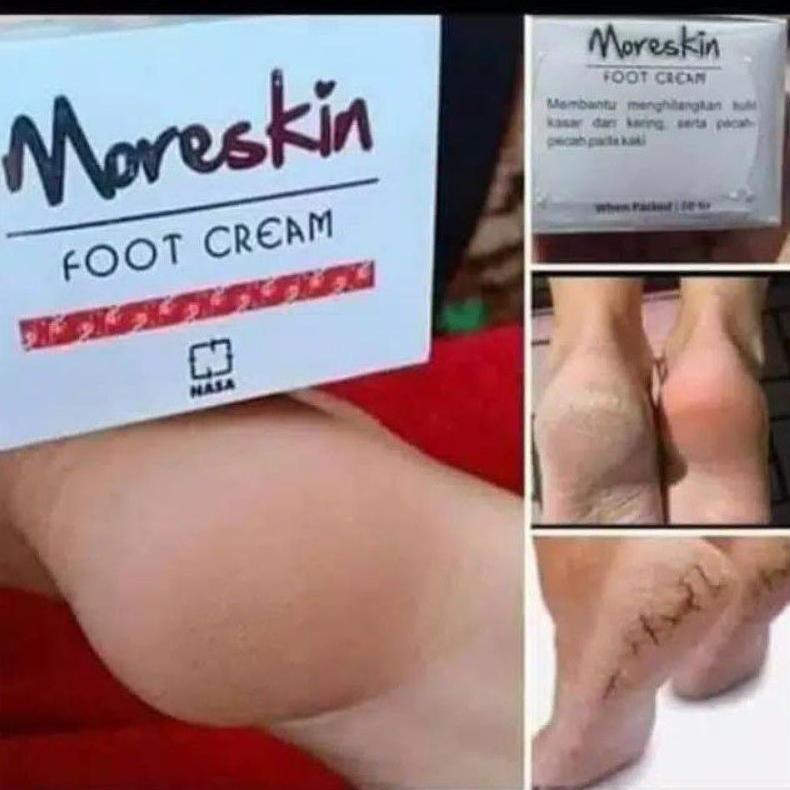 NEW Cream kaki pecah2 - Obat kaki pecah2 - Obat kaki pecah dan kering  - Food Cream Nasa - Cream kak