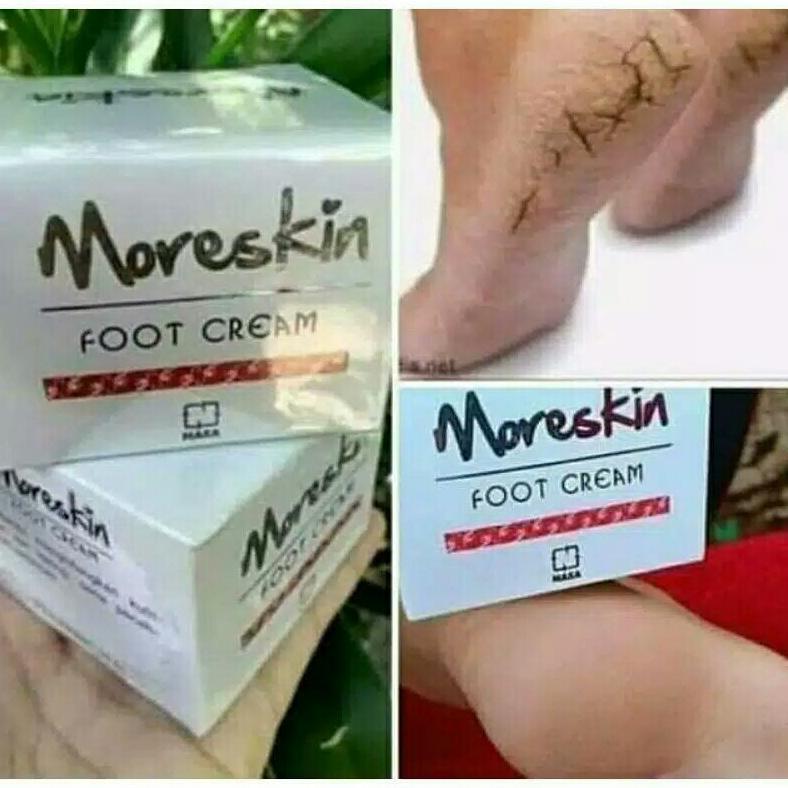 NEW Obat kaki pecah2 - Obat kaki pecah dan kering  - Food Cream Nasa - Cream kaki pecah2 - Cream kak