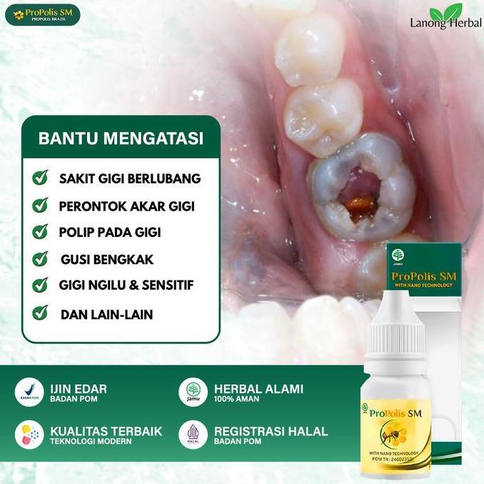 Obat Pencabut Gigi Berlubang Perontok Gigi Sampai Akar Penghancur Gigi Berlubang Cepat Sembuh