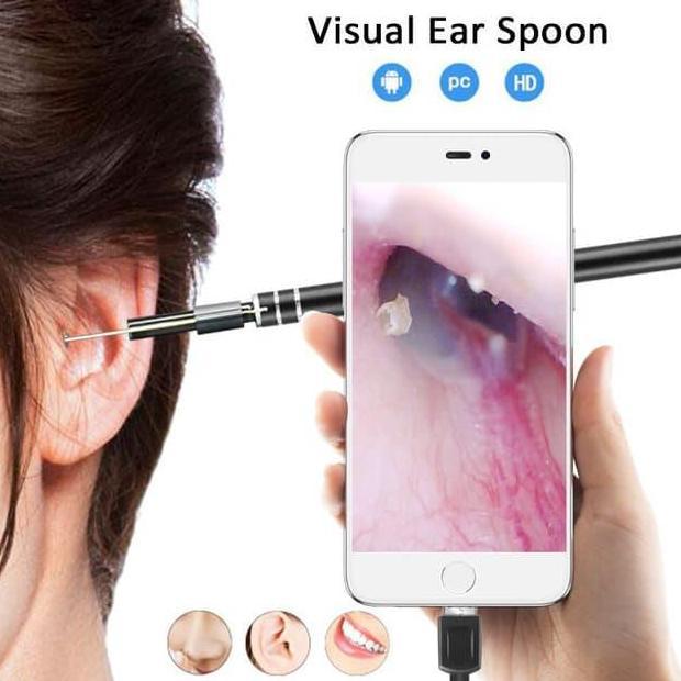 EFLUDOP Kamera Endoskopi u/ Pengecekan & Pembersihan THT Via Android HP & PC