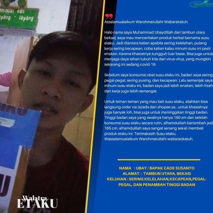 Susu Untuk Patah Tulang, Susu Tulang Retak, Susu Tulang Bergeser, Susu Tinggi Kalsium, Obat Patah Tu