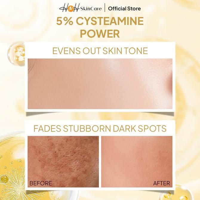 Younice- Signature By Kamila - Cysteamine Glow Booster Whitening Solution - Serum Cysteamine Untuk F