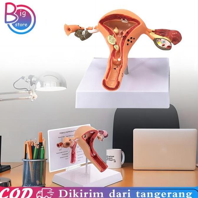 URB Uterus Ovary Anatomical Model Anatomy Alat Peraga Anatomi Model Patologis Uterus Ovarium Manekin