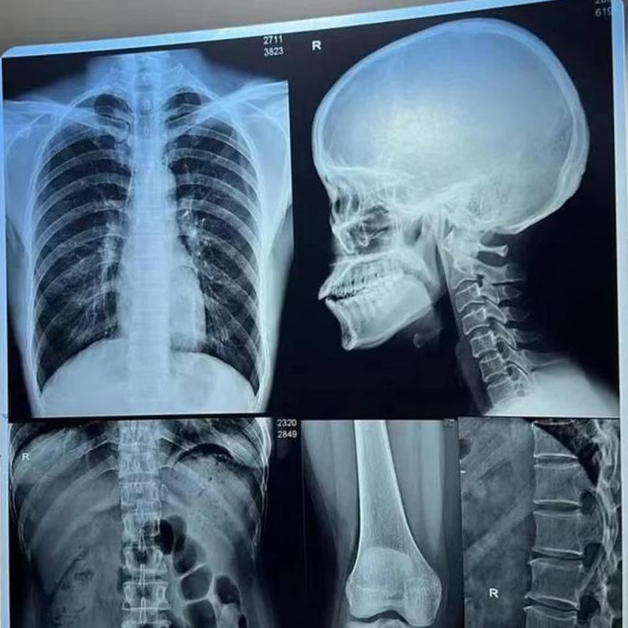 DIGITAL FILM INKJET MEDICAL DRY FILM A4