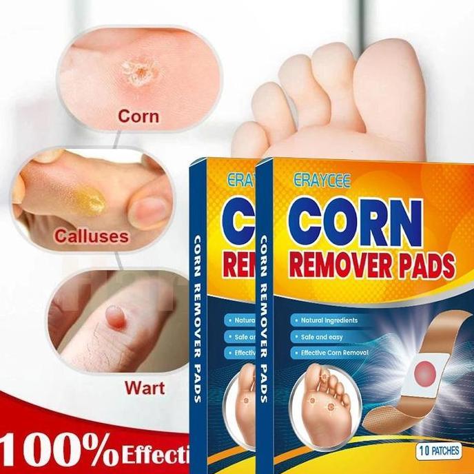 Cod,Sis- Plester Mata Ikan Plester Obat Kutil Foot Corn Removal Penutup Kutil Obat Mata Ikan Kapalan