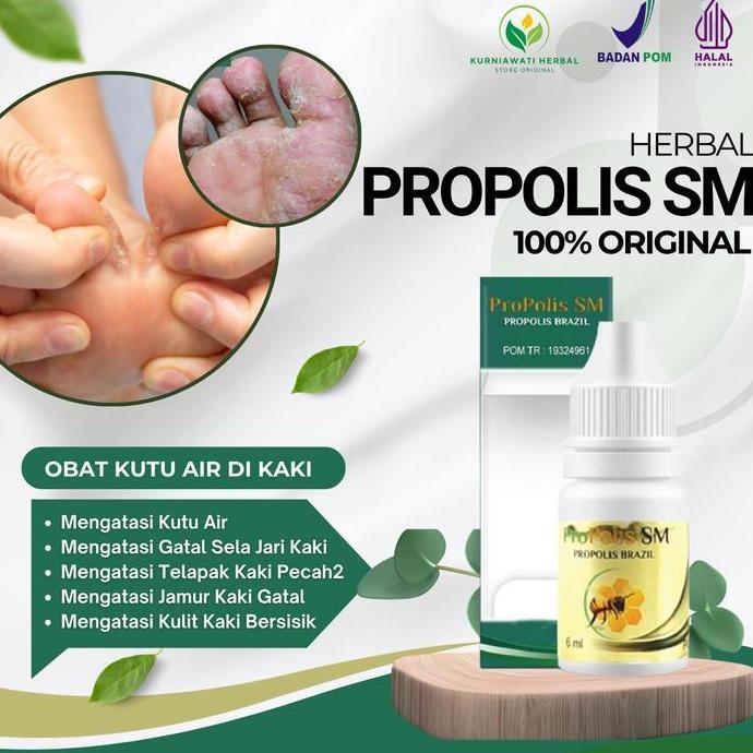 Obat Kutu Air, Gatal Sela-Sela Jari Kaki, Kutu Air Di Kulit Kaki, Jamur Kaki Gatal, Telapak Kaki Pec