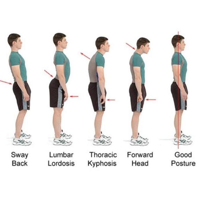 POSTURE CORRECTOR PENEGAK PUNGGUNG POSTUR PENYANGGA PUNGGUNG WANITA