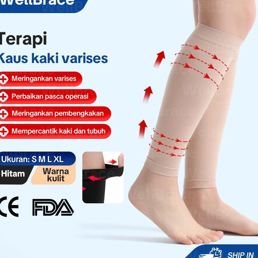 Kaos Kaki Kompresi Untuk Kaki Bengkak Diabetes Stoking Varises Ccl 2 Medis Original Stoking Varices