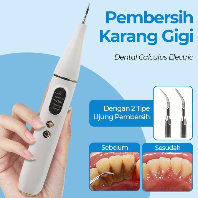 LADHUVHI Alat Pembersih Karang Gigi Dental Scaling Ultrasonic Dental Calculus Electric